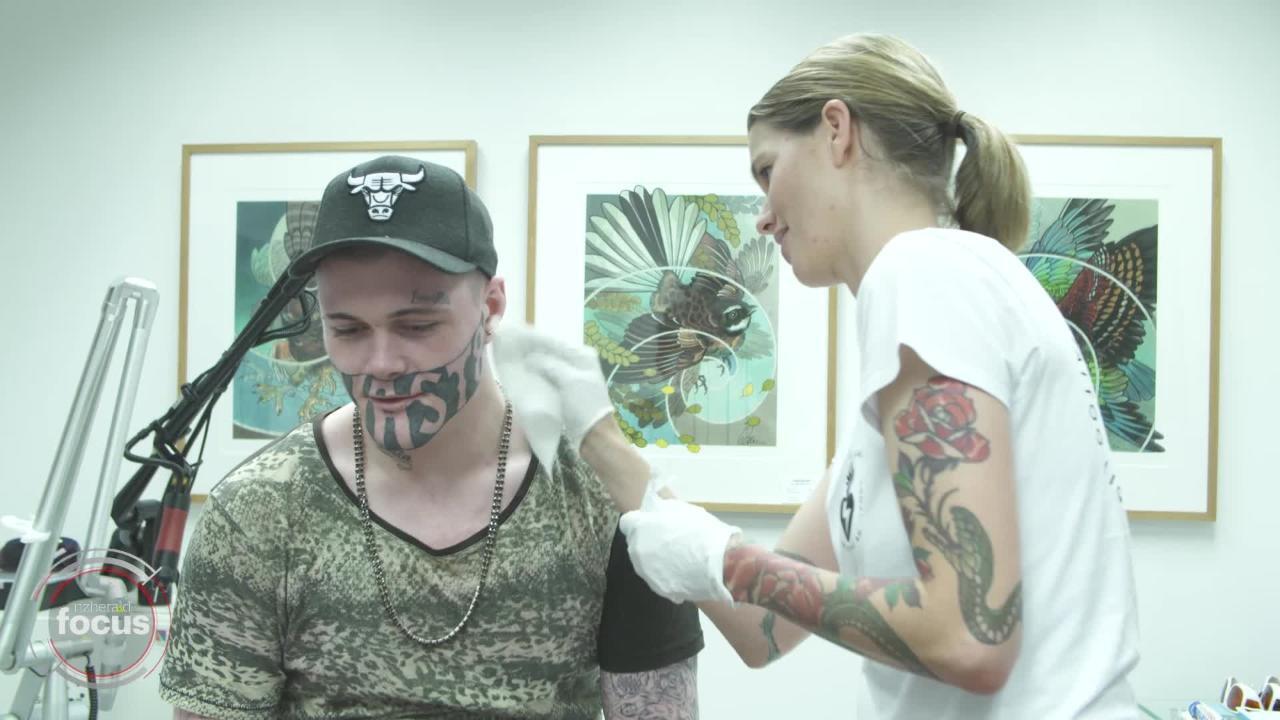 Laser Tattoo Removal in Las Vegas | TikTok