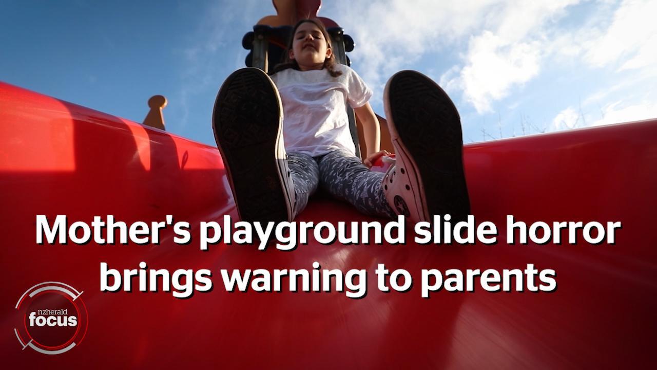 Mum warns of playground mistake after toddler breaks his leg