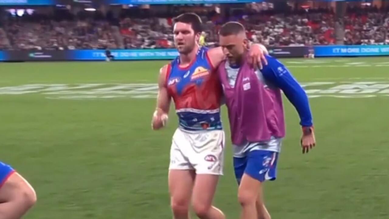 Western Bulldogs player limps off after hamstring injury