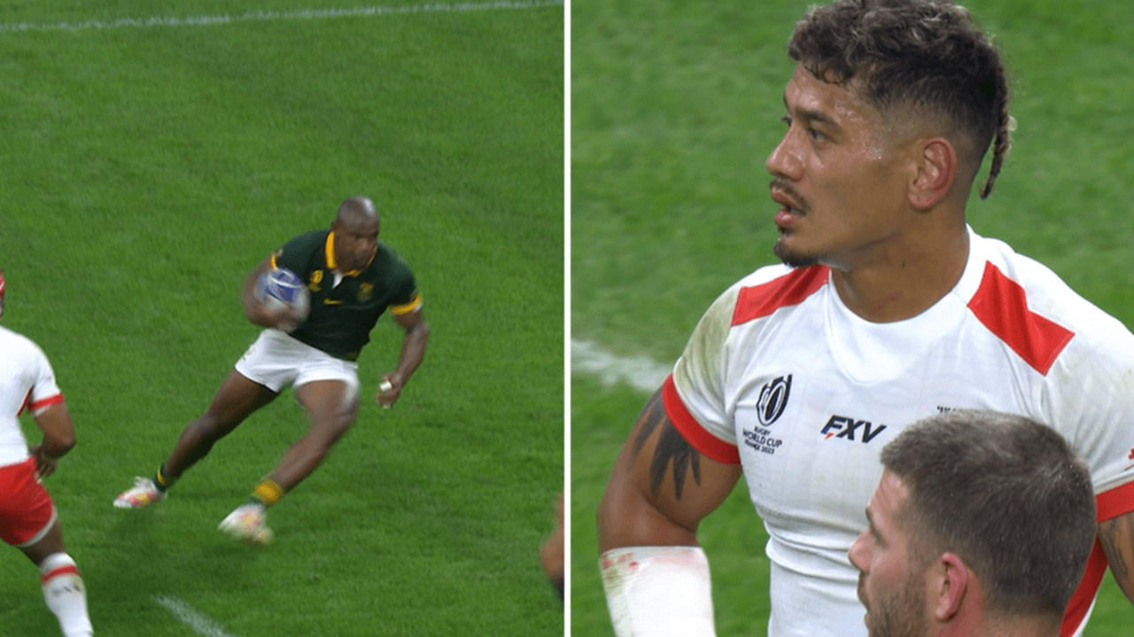 Springboks star suffers broken eye socket in ugly hit