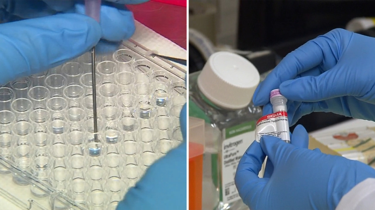 Doctors call for more support for long COVID