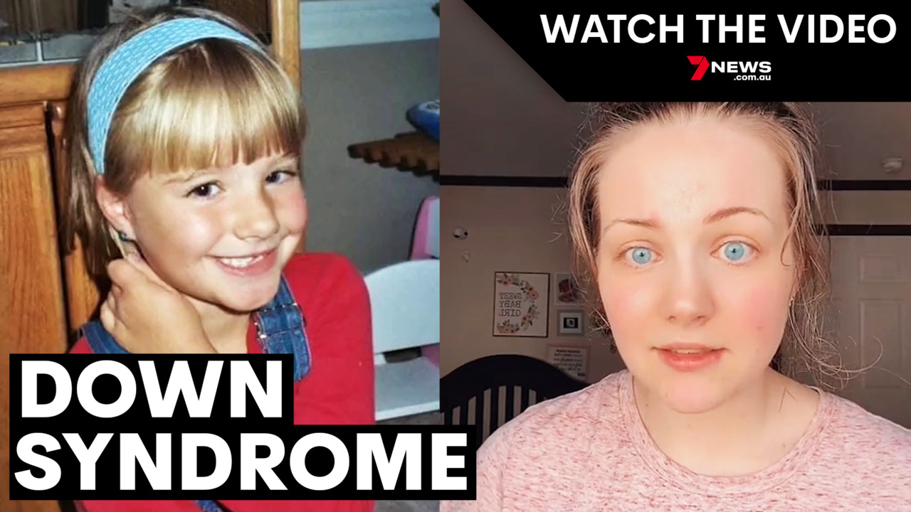 Woman Is Diagnosed With Down Syndrome as an Adult After Warning Signs