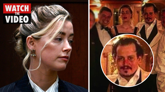Amber Heard claims pic of Johnny Depp with black eyes is