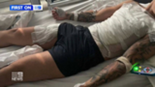 Calls to ban hot water bottles after Melbourne man severely burned
