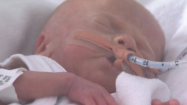 World First discovery in tiny babies - Monash Children's Hospital